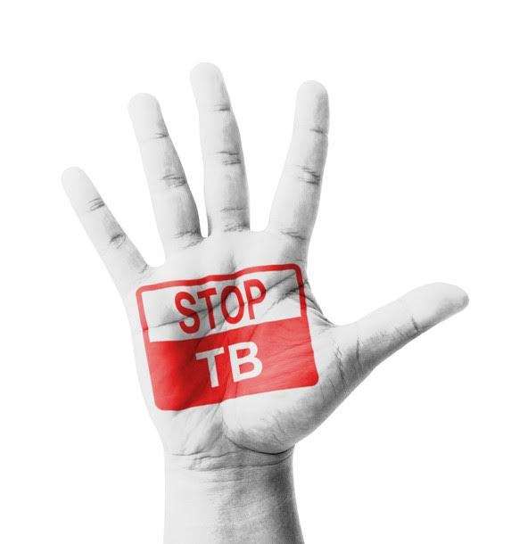 Tuberculosis in the United States