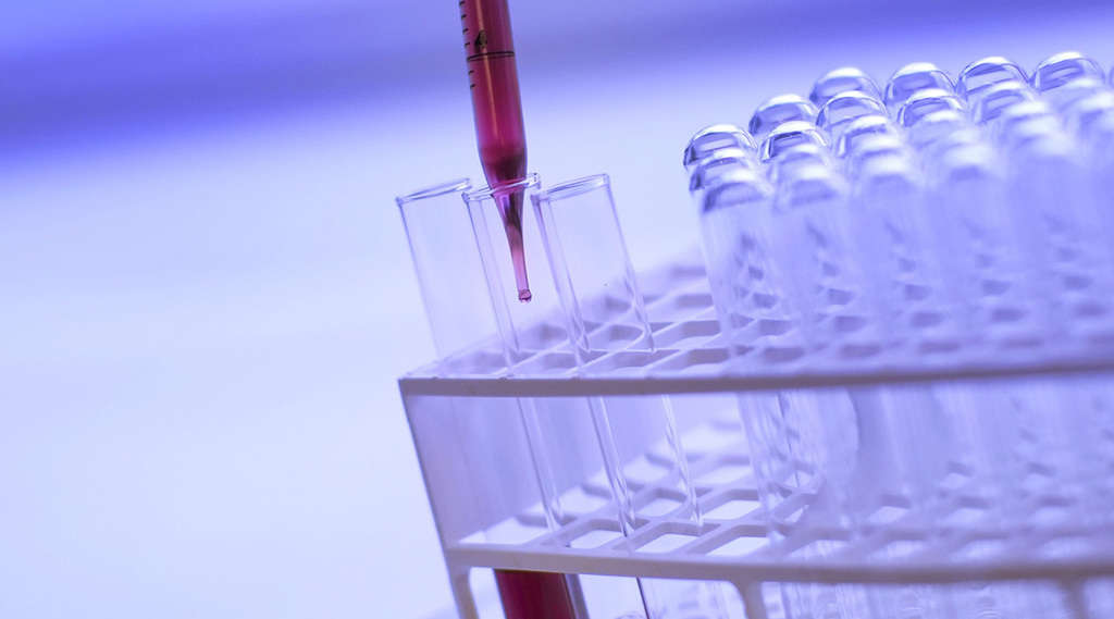 What is a Titer Test?
