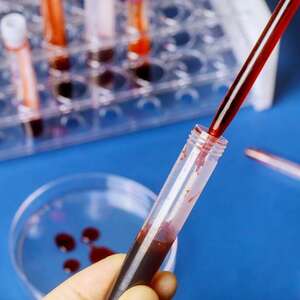Blood Titer