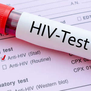 What Are My Options for HIV Blood Testing?