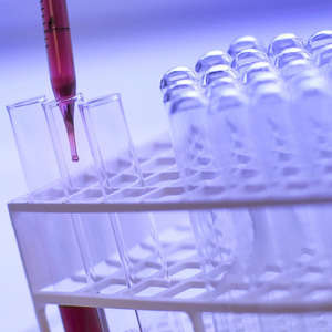 What is a Titer Test? 