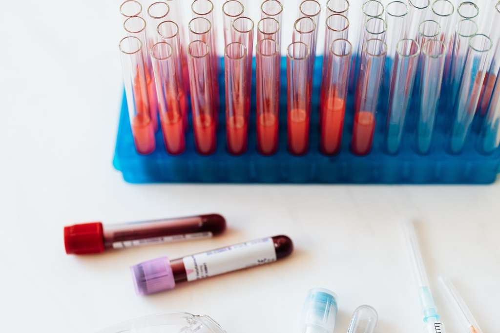 Blood samples in test tubes