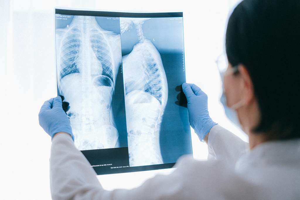 A Las Vegas radiologist holding a chest x-ray result