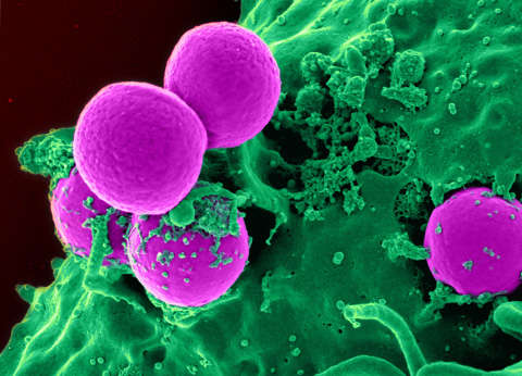 purple cells