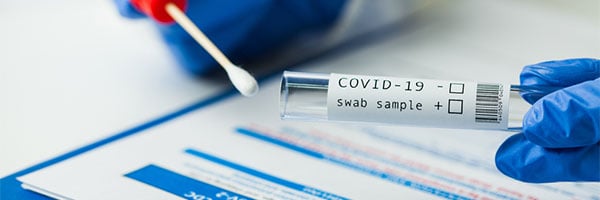 COVID-19 PCR Testing